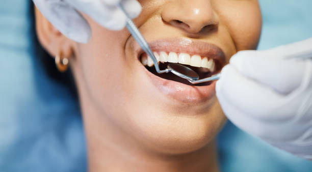 Best After-Hours Dental Trauma Care in Crooks, SD
